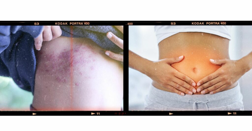A picture of allergies and stomach